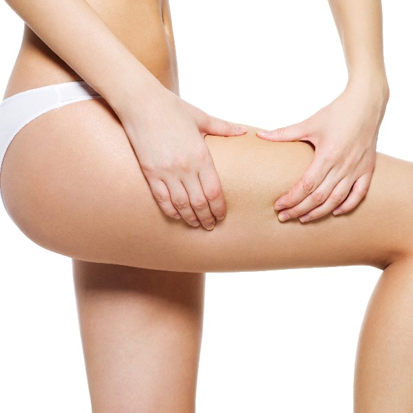 Cellulite removal